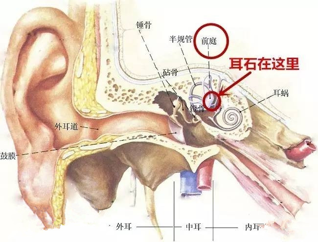 眩暈并伴有惡心 小心“耳石癥”找上你