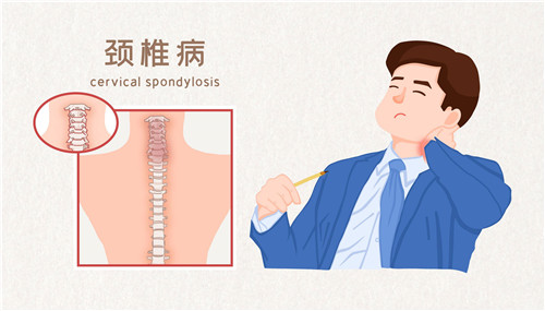 網(wǎng)傳頸椎病“自救指南”靠譜嗎？專家解讀來(lái)了