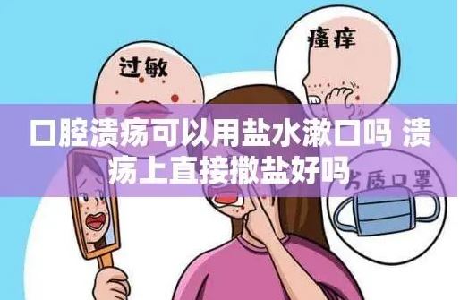 口腔潰瘍 撒鹽喝酒消毒有用嗎？