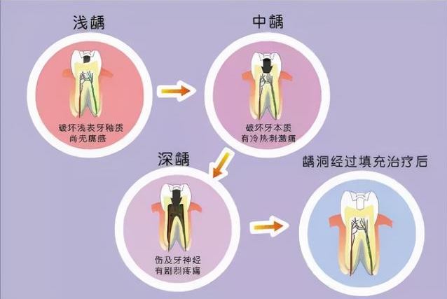 牙疼真相大揭秘 11個應(yīng)對方案送給你