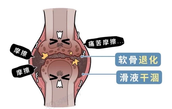 且行且珍“膝” 保護(hù)膝蓋建議做好這幾件事