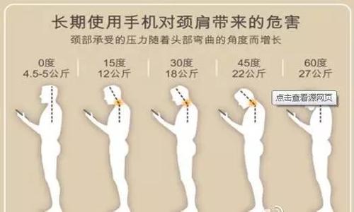 男子伸懶腰變高位截癱 醫(yī)生：低頭族易中招